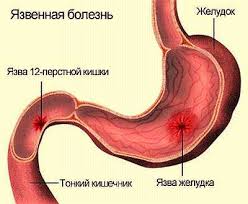 Без названия (4).jpg